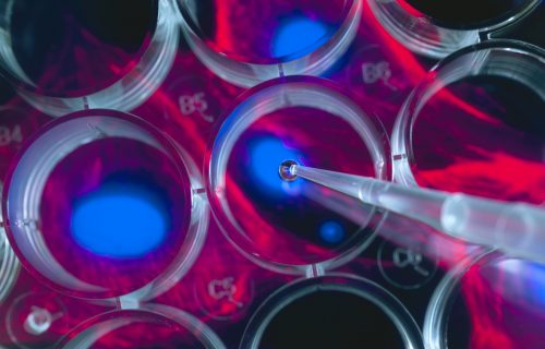 Stem cell research, scientist pipetting cells into a multi well plate with screen image of stem cells in the background