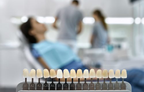 Teeth shade guide on the blurred background of a dental cabinet with patient and dentists